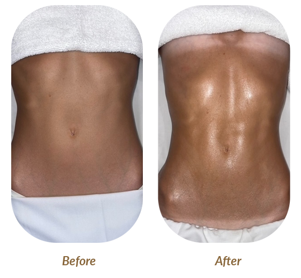 Premium Lymphatic Care Near You